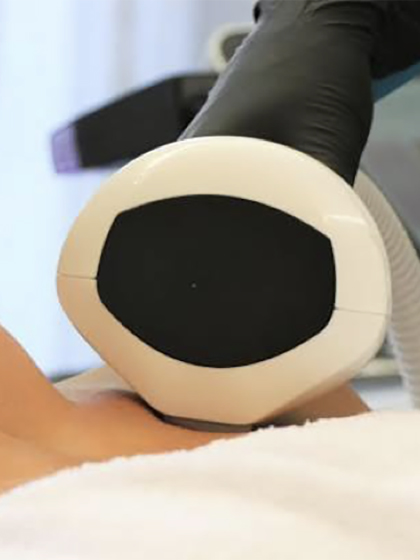 Laser IPL